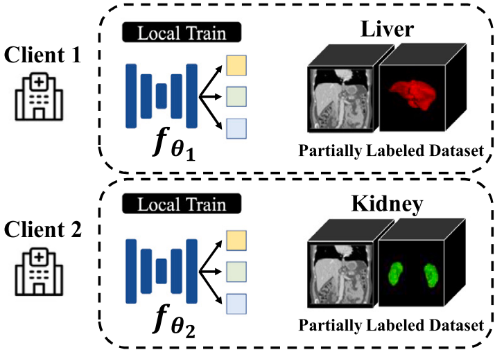 Federated learning with knowledge distillation for multi-organ segmentation with partially labeled datasets