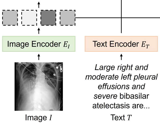 LoFi: Location-Aware Fine-Grained Representation Learning for Chest X-ray