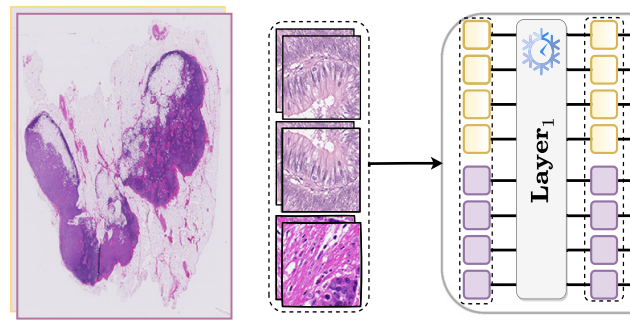 Low-Shot Prompt Tuning for Multiple Instance Learning Based Histology Classification