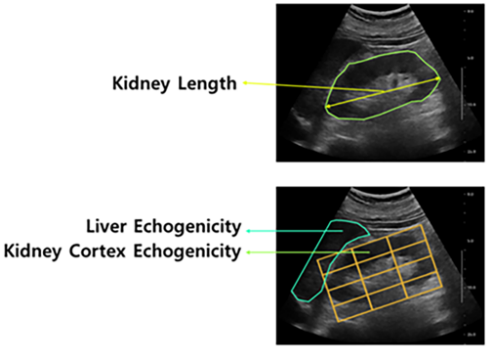 Machine Learning–Aided Chronic Kidney Disease Diagnosis Based on Ultrasound Imaging Integrated with Computer-Extracted Measurable Features