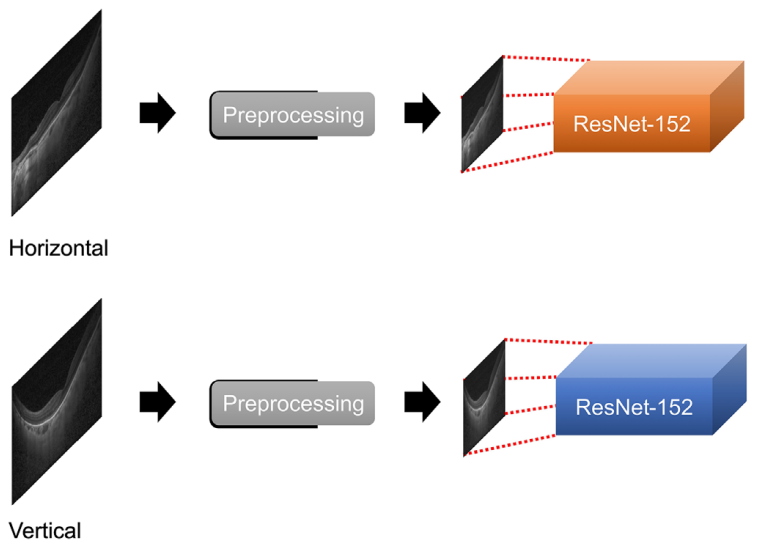 Prediction of Axial Length From Macular Optical Coherence Tomography Using Deep Learning Model