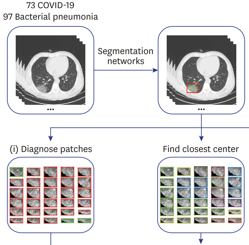 Quantitative Assessment of Chest CT Patterns in COVID-19 and Bacterial Pneumonia Patients: a Deep Learning Perspective