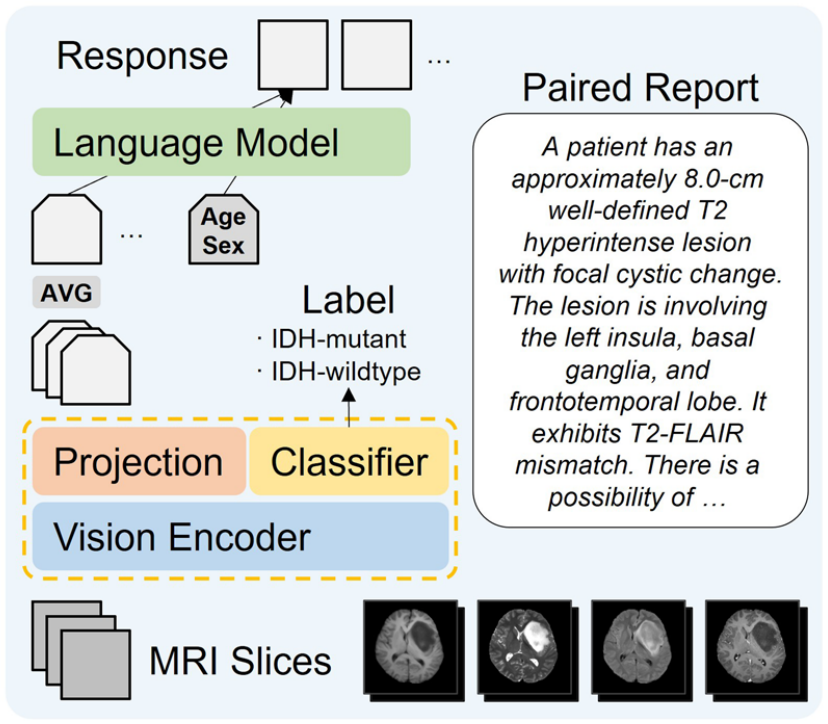 A robust vision language model for molecular status prediction and radiology report generation in adult-type diffuse gliomas