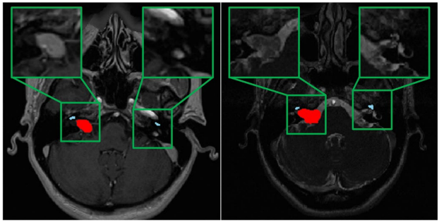 Target-aware cross-modality unsupervised domain adaptation for vestibular schwannoma and cochlea segmentation