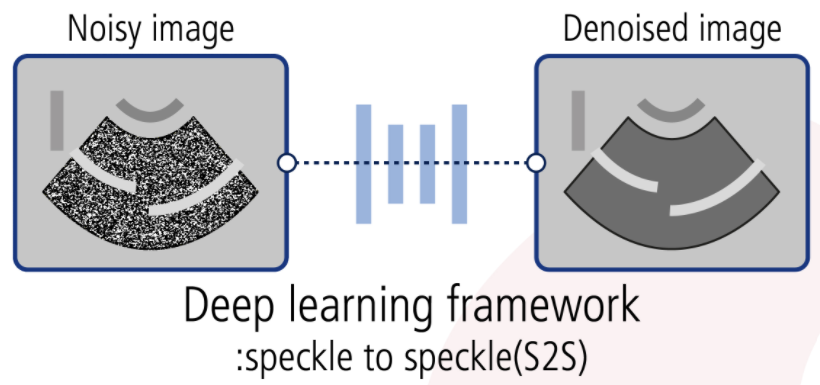 Unsupervised speckle noise reduction technique for clinical ultrasound imaging
