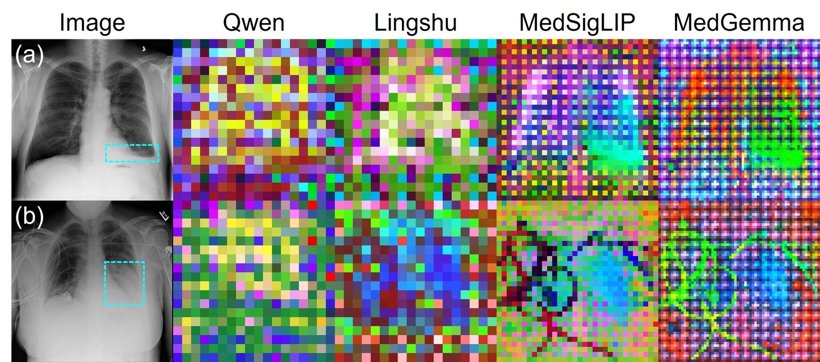 PCA maps of patch-level features from Qwen, Lingshu, MedSigLIP, and MedGemma