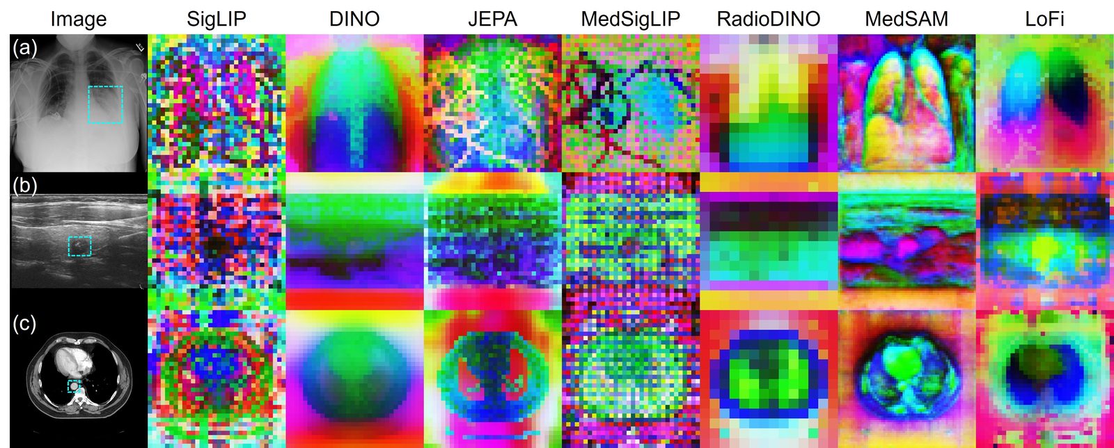 PCA maps of patch-level features from SigLIP, DINO, JEPA, MedSigLIP, RadioDINO, MedSAM, and LoFi