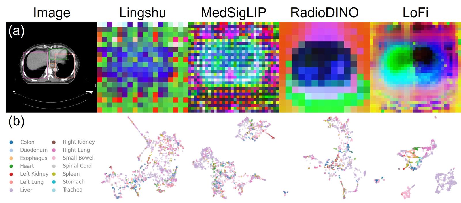 PCA maps and PaCMAP projections of patch-level features from Lingshu, MedSigLIP, RadioDINO, and LoFi