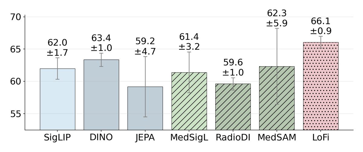 VQA-RAD results